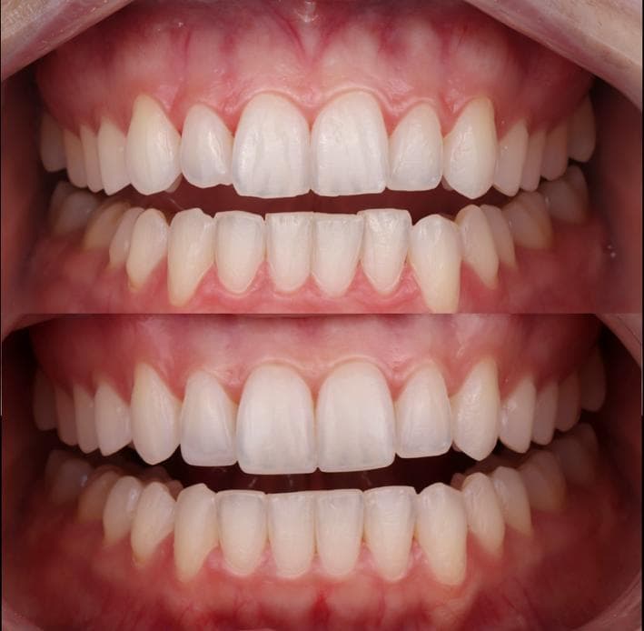 Estética dental