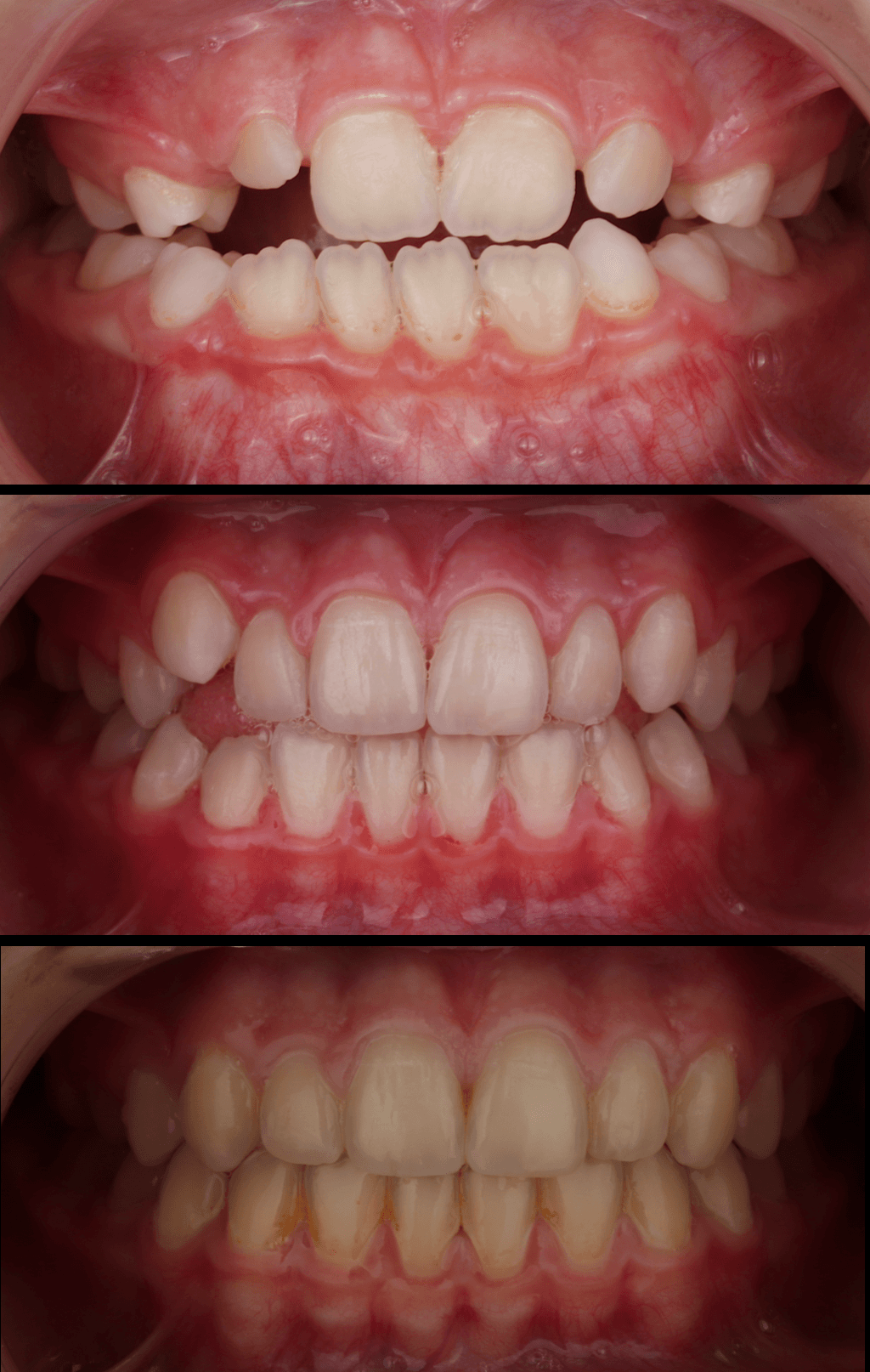 Odontopediatría