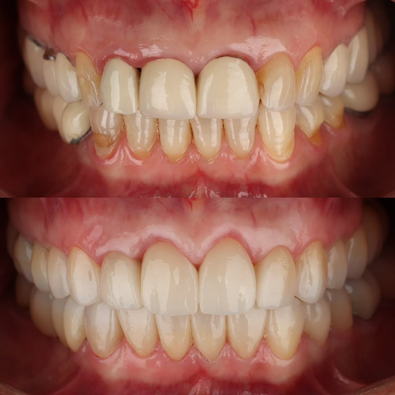 Rehabilitación oral